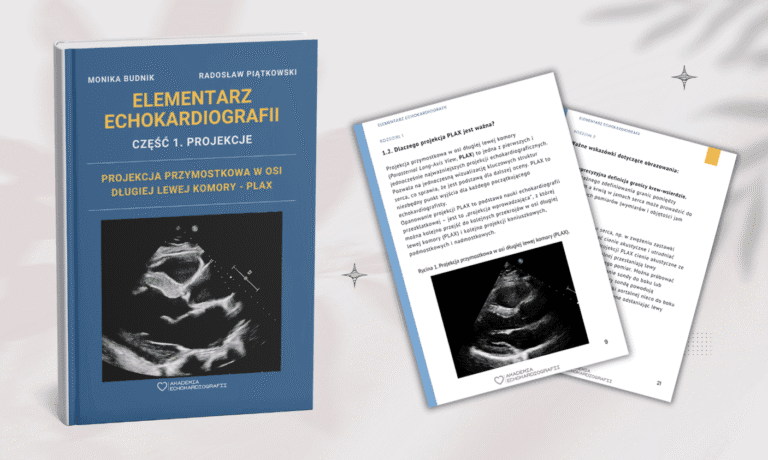 E-book Elementarz Echokardiografii, część 1: projekcja PLAX